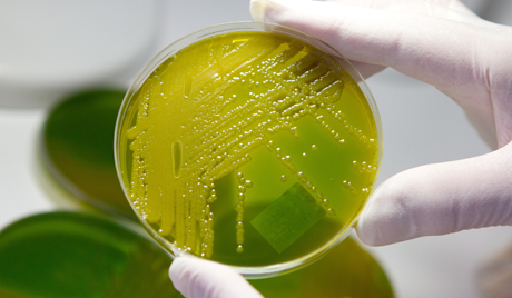 EHEC - no end to the infection in sight